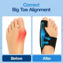 For Women & Men (2 Pack) Hammer Toe Straightener, Bunion Relief, Big Toe Separator, Adjustable Day & Night Support, Comfortable, One Size Fits All - 1Pair - View 9