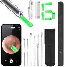 Ear Wax Removal Tool Camera - 1080P HD Ear Cleaner With Light, Earwax Removal Kit For Ear Cleaning,  Ear Camera For Adults Kids Pets Ear Camera For IOS & Android - Black - View 1
