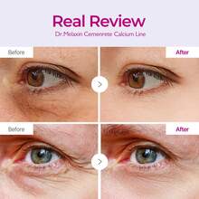 Dr.Melaxi Cemenrete Calcium Volume Eye Patch 60ea - Cemenrete Eye Patch - 查看 3