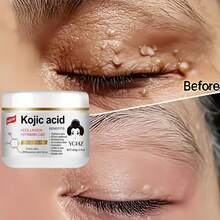 曲酸保湿霜——蕴含透明质酸、维生素C和E、烟酰胺和胶原蛋白——提亮肤色，紧致肌肤。这款美白霜可淡化色斑，男女皆宜。60克 - 60g - 查看 3