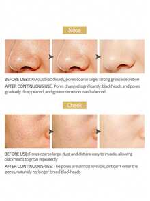 Salicylic Acid & Blackhead Peel-Off Mask – Deep Pore Cleansing,Strong Pulling Design,Oil Control,Blackhead Removal,Acne And Whiteheads,Non-Tightening Post-Use,Tender And Smooth Skin,Brightening Skin,Shrink Pores,Moisturize,Suitable For All Skin Types - 黑色的 - 查看 3