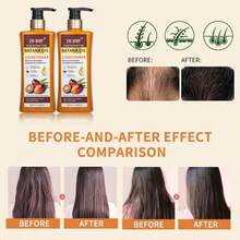 爆款100%纯巴塔纳油洗发水✨ DR-WWP 促进头发生长，强韧发丝 - 500毫升 - 巴塔納 - 查看 3