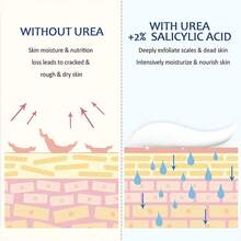 修复滋养尿素霜，适用于干燥皲裂的脚后跟、脚部、膝盖、手肘和手部，去除足部死皮、角质层、老茧，软化趾甲，角质溶解修复皮肤屏障 - 清香 - 查看 3