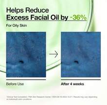 Anua Azelaic Acid 10 Hyaluron Redness Soothing Serum 30ML - Azelaic Acid - View 7