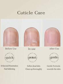 15ml Cuticle Oil Treatment - Nail & Cuticle Softener And Remover, For Nail Salon Care Before Manicure - 15ml軟化劑 - 查看 5
