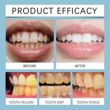 1盒1支（3毫升）牙龈护理凝胶，温和清洁口腔，清新口气，呵护牙龈 - 凝膠 - 查看 10