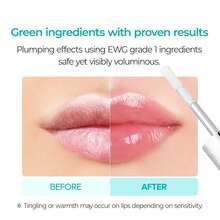 Volume & Lift Essentials Bundle, With Calcium Multi Balm & BP Spicule Plumping LIP Shot, All In One, Korean Skin Care - Volume & Lift Essentials - View 3