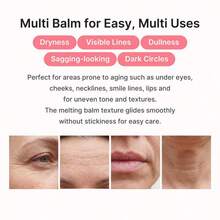 PDRN Pink Collagen Volume Multi Balm | All In One Volufiline, PDRN, NAD Stick For Youthful-Looking, Helping Look Of Fine Lines, Firming Care, Anti-Aging Care | For Under-Eyes, Neck, Forehead, Smile Lines, Lip Care | Korean Skincare - 1pc - 查看 7