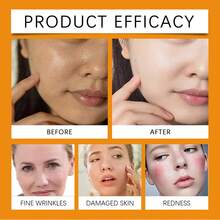 Facial Essence: Moisturizing, Hydrating, Nourishing, Firming, And Refining Facial Skin Care Essence Liquid - Multi Scents - View 8