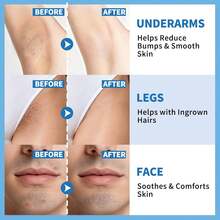 Razor Bump & Ingrown Hair Treatment - Razor Bump Smoothing Solution Ingrown Hair Serum, Razor Bump Ingrown Treatment Hair Face, Armpits,Bikini Area - Màu xanh lam - Xem 6