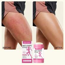 Anti-Chafing Stick - Waterproof, Sweat-Resistant, Easy-To-Apply Balm Stick To Prevent Chafing On Thighs, Heels And Forearms. - Anti-wear - View 1