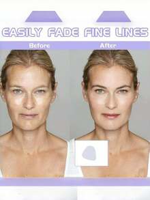 4pcs/9pcs/1box Japanese For Nasolabial Folds, Glabellar Lines & Crow's Feet – Smooth & Fade Fine Lines - Multicolor - View 9