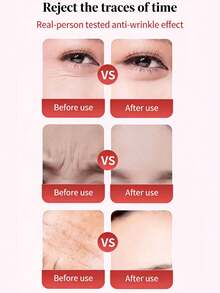 4pcs/9pcs/1box Japanese For Nasolabial Folds, Glabellar Lines & Crow's Feet – Smooth & Fade Fine Lines - Multicolor - View 8