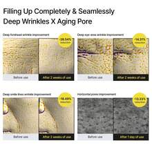 Tinh chất collagen tăng cường hàng rào bảo vệ da | Collagen thật, Peptide, Dưỡng ẩm, Chống nhăn, Phù hợp cho da khô và da có nếp nhăn - trắng - Xem 10