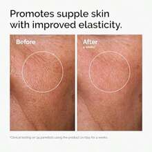 Most Loved Collection For Even Skin Tone And Texture - Skin Care Bundle Set - Hyaluronic Acid 2% + B5, Niacinamide 10% + Zinc 1%, Ordinary Caffeine Solution 5% + EGCG - 3 cái - Xem 6