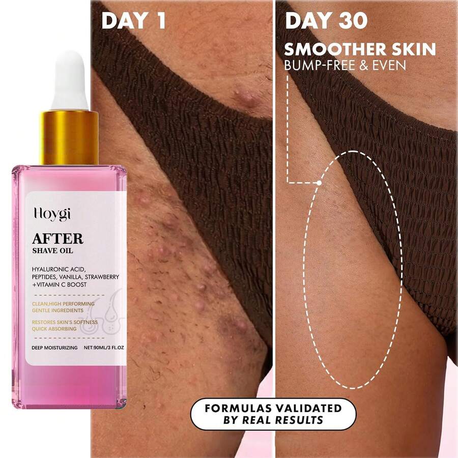 After Shave Oil For Razor Bumps And Post-Shave Irritation, Lightweight Non-Greasy Soothing Care For Face And Body - Aftershave Essential Oil - View 1
