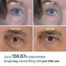 Dr.Melaxin Eye Care - Hyaluronic Acid - View 3