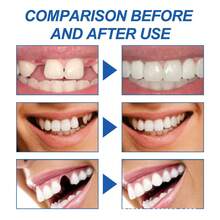 Moldable Fake Teeth Dental Wax, Temporary Tooth Filler For Film/Makeup, Party/Event Decoration - Non-Adhesive, Silicone Filling Product - Multicolor - View 4
