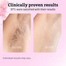 Cyperus Rotundus Oil - 60ml Natural Cyperus Rotundus Oil For Hair Removal, Moisturizing & Soothing Cyperus Oil For Reducing Body Hair Growth, Hair Removal Oil Ideal For All Skin Types - 凝膠 - 查看 4