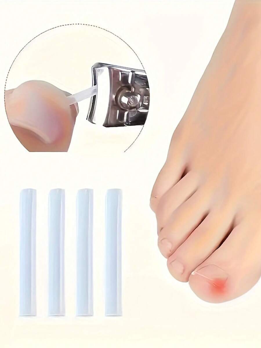 Bộ dụng cụ chăm sóc chân, gồm 10/20/30/40/50/60/70/80/90/100 món, dùng để điều trị móng chân mọc ngược.