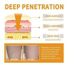 Exercise Repair Relieve Veins Leg Repairing Cream Mild Leg Massage Soothing Body Care Leg Relief External Use - Default - View 4
