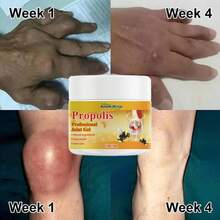 Bee Veno Joint Cream & Massage Gel | Muscle Gel For, Knee, Hip, Back, Hands, Legs Lower Back, Shoulder, Neck & Muscle Soreness, Relieves Joint Pain & Repairs Joints Designed For Seniors & Athletes Fitness - 維生素 C - 查看 5