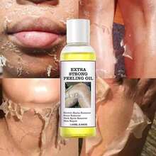 Yellow Peeling Oil For Dark Skin Strong Peel Oil Extra Strength Exfoliating Chemical Exfoliant Peels Solution At Home Body Peeling For Exfoliate Body Hand Foot Knuckle All Skin Type - Default - View 1