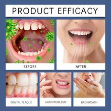 Kit de enjuague bucal con aceite de coco y menta para refrescar el aliento, eliminar la fragancia duradera, combatir las manchas en los dientes, mantener la salud de las encías y cuidar la salud bucal con raspador de lengua. - Mentol de coco - Ver 10