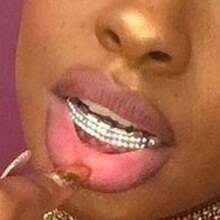 1 Set Personalized 6-Tooth Double Row Rhinestone Hip Hop Grillz, Unisex Party & Dance Accessory - Multicolor - View 2