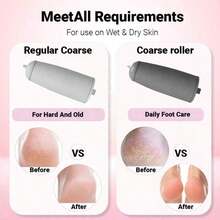 Electric Foot File, Foot Callus Remover, Equipped With Two Different Grinding Heads, Two Speed Settings, Automatic Lighting, For Better Removal Of Foot Calluses The First Choice For Giving Gifts, Perfect For Loved Ones, Mothers, And Elders. - Default - View 7