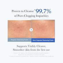 Medicube Zero Pore SA Clear Capsule Cleansing Foam 120g - Nettoyant - View 3