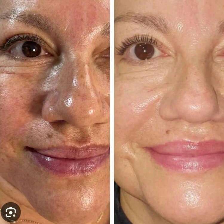 Kem dưỡng trắng da chiết xuất cà rốt collagen tự nhiên 330ml, nuôi dưỡng da, tạo làn da mịn màng và khỏe mạnh. - Nhiều màu - Xem 7