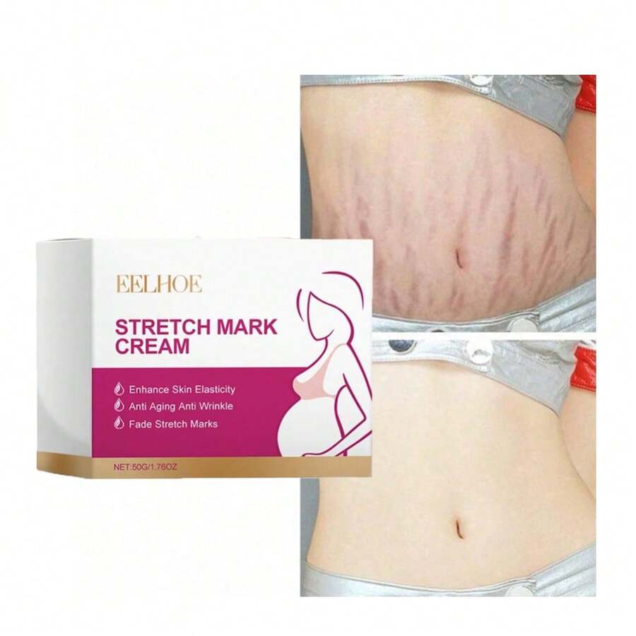 Stretch Mark Creams & Oils - Stretch Mark Cream - View 1