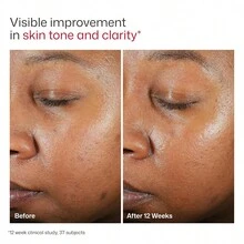 EltaMD – Écran solaire teinté pour le visage 48g - UV Clear SPF 46 - Écran solaire teinté - Voir 8
