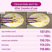 Dr.Melaxin Eye Care - Patches Pour Les Yeux - View 2