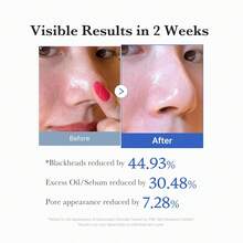 Medicube Zero Pore Pad 155 G (70 Pads) - Zero Pore - View 5