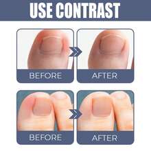 west month Nail & Cuticle Care Oil Natural Toenail Softening Oil For Ingrown Nails Nourishes Softens Nails Soothes Discomfort Keeps Nails Cuticles Healthy Gentle Formula For Fingernails Toenails Daily Nail Care - 10ml - View 7