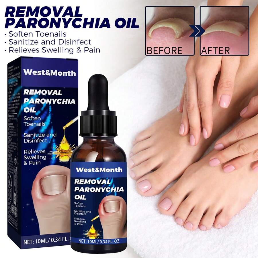 west month Nail & Cuticle Care Oil Natural Toenail Softening Oil For Ingrown Nails Nourishes Softens Nails Soothes Discomfort Keeps Nails Cuticles Healthy Gentle Formula For Fingernails Toenails Daily Nail Care