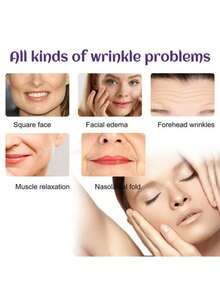 10 Peças Adesivos Faciais, Usados para Melhorar as Dobras Nasolabiais, Levantar a Pele Facial, Apertar os Cantos da Boca e Bochechas, Adesivos Faciais, Use Consistentemente Adesivos Faciais para Nutrir a Pele Facial, Suavizar as Dobras Nasolabiais, Pode nos Fazer Voltar ao Campus, Parecer Melhor Quando Estiver na Escola, Use Durante a Vida Escolar Diária, Participando de Atividades, Festivais e Antes de Feriados. - Branco - Visão 6