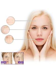 10 Peças Adesivos Faciais, Usados para Melhorar as Dobras Nasolabiais, Levantar a Pele Facial, Apertar os Cantos da Boca e Bochechas, Adesivos Faciais, Use Consistentemente Adesivos Faciais para Nutrir a Pele Facial, Suavizar as Dobras Nasolabiais, Pode nos Fazer Voltar ao Campus, Parecer Melhor Quando Estiver na Escola, Use Durante a Vida Escolar Diária, Participando de Atividades, Festivais e Antes de Feriados. - Branco - Visão 4