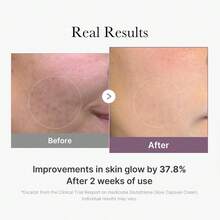 Moisturizers - AGE-r Cream - View 6
