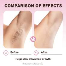 1-5PCS Multi-Piece Set Cyperus Rotundus Oil Skincare Products- 60ml Natural Cyperus Rotundus Oil For Hair Removal, Facial Care Products,Moisturizing & Soothing Cyperus Oil For Reducing Body Hair Growth, Hair Removal Oil Ideal For All Skin Types,Essential For Daily Life,Korean Skincare Products,Essential Holiday Gifts. - 2 chiếc - Xem 5