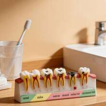 Dental Caries Progression Model, Including Normal, Superficial, Moderate, Severe, Residual Root, And Inherited Tooth Stages, Detailed Visualization Of Dental Disease Development For Oral Health Education, Dental Clinic Decoration, Patient Explanation, And Home Learning, Unique Dental Health Learning Decoration Suitable For Dental Clinics, Home Learning, And Science Teaching - A - View 4