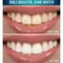 Set 2 en 1 de Tiras Blanqueadoras y Funda Dental Reutilizable, Blanqueamiento Rápido para Dientes - Conjunto de frenillos y tiras blanqueadoras - Ver 8