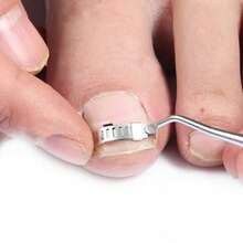 Ensemble d'outils de lime à ongles avec outils de réparation des ongles incarnés, comprenant des coupe-ongles et des outils de réparation des ongles d'orteils, résolvant facilement les problèmes d'ongles incarnés, convenant à divers besoins de soins des pieds - Multicolore - Voir 5