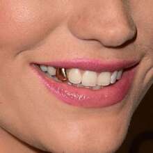 1pc/4pcs Classic Smooth Single Tooth Grillz, Unisex Hip Hop Teeth Jewelry For Daily Wear, Holiday Gift - Multicolor - View 3