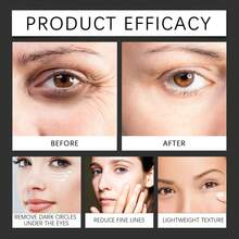 west month 20克视黄醇眼霜，蕴含咖啡因、胶原蛋白和烟酰胺，深层滋润，提亮肤色，淡化细纹和黑眼圈，紧致肌肤。 - Retinol - 查看 11