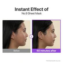 Facial Masks - 4pcs NAD Mask - View 4