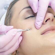 6-Piece Ultra-Precision Acne Tweezers Tool Set - Facial Blackhead Removal Tool - Effectively Cares For And Purifies Facial Skin - Silver - View 9