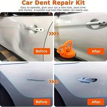 3pcs Car Dent Puller, A Powerful Dent Removal Tool For Car Dent Puller Kits And Car Body Dent Glass Tile And Mirror Paint Free Dent Repair - 1Large+2small - View 7